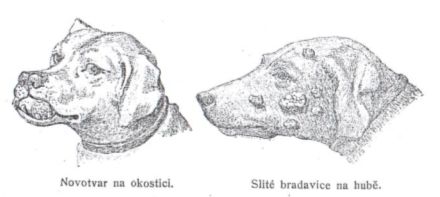 Novotvar na okostici - Slité brabavice na hubě