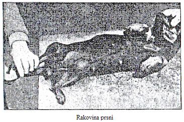 Rakovina prsní